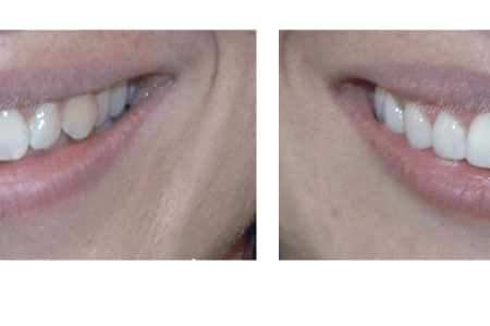 Αισθητική αποκατάσταση